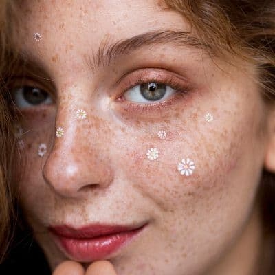 Milia: por qué salen los granitos blancos y duros y cómo eliminarlo