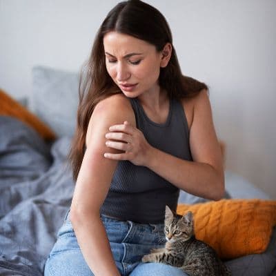 Escabiosis (sarna): síntomas, contagio y cómo eliminarla de casa