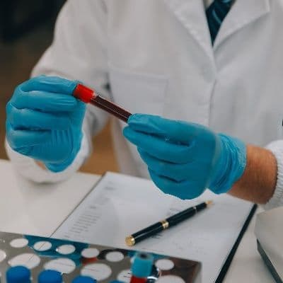 El proceso de fagocitosis: cómo se limpia tu sangre