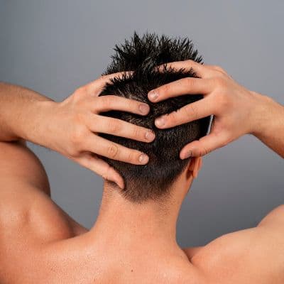 Micropigmentación capilar: la solución de efecto rapado para la alopecia