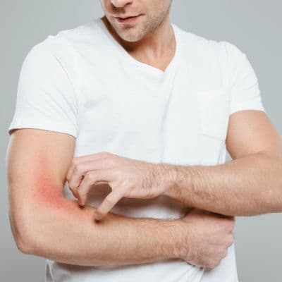 Guía completa sobre los alérgenos alimentarios