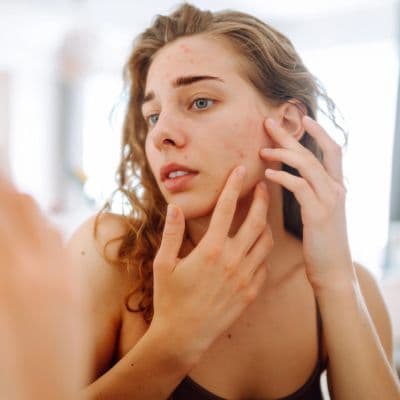 Cuando tu piel reacciona a la comida: la guía de los síntomas dermatológicos
