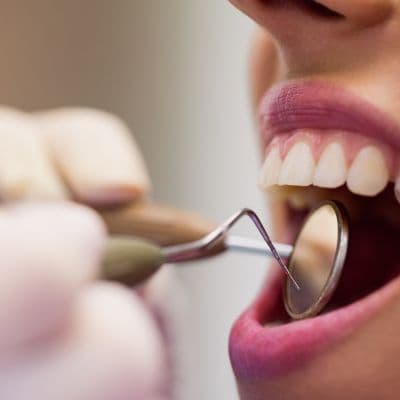 Anestesia local en dentista: duración y efectos