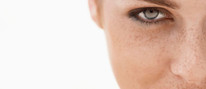 ¿Tienes manchas en la piel? Cuándo preocuparse y consultar al dermatólogo