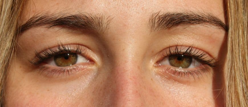 Ese bulto doloroso en el lagrimal que te hace llorar sin querer y se llena de pus