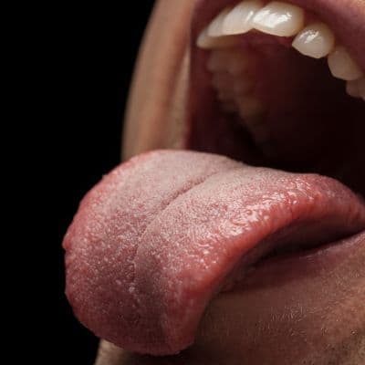 ¿Bultitos rojos en la lengua? Por qué se inflaman tus papilas y cuándo preocuparte