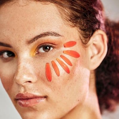 Lentigo solar: diferencias con el melanoma y cómo eliminarlos