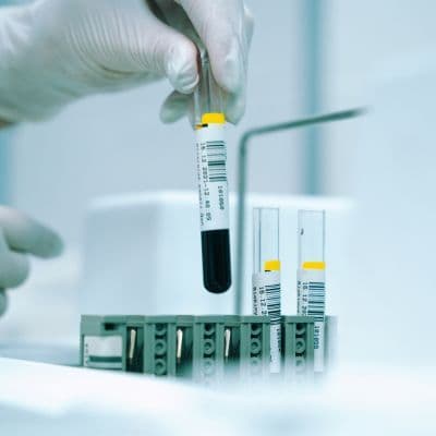 ¿Cansancio y llagas? La sentencia de riesgo por leucocitos bajos hoy