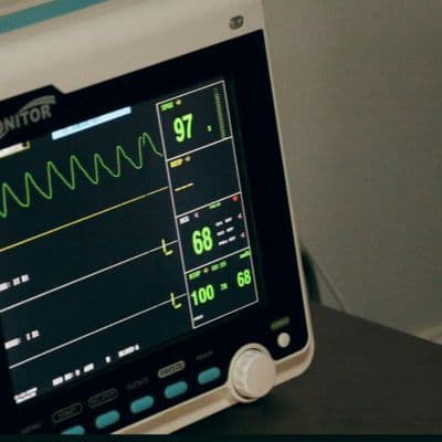 Por qué la tensión arterial media es más importante para tu corazón que la máxima