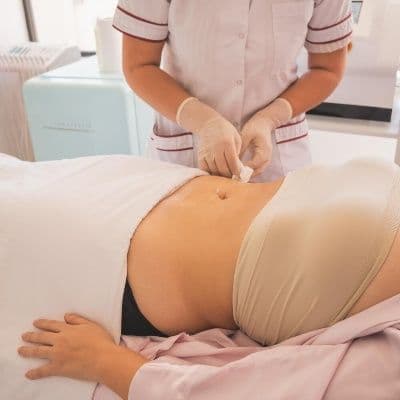 La técnica de radiofrecuencia que cierra los tejidos del abdomen tras el embarazo