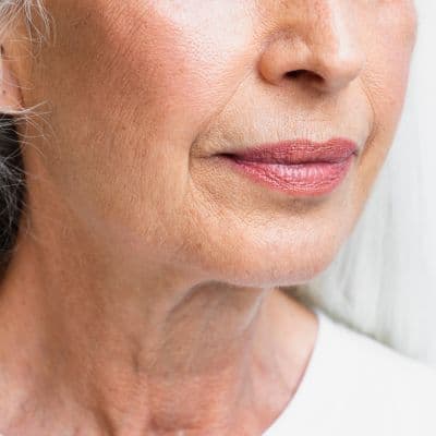 ¿Arrugas en los labios? El truco para borrarlas sin pinchazos ni agujas