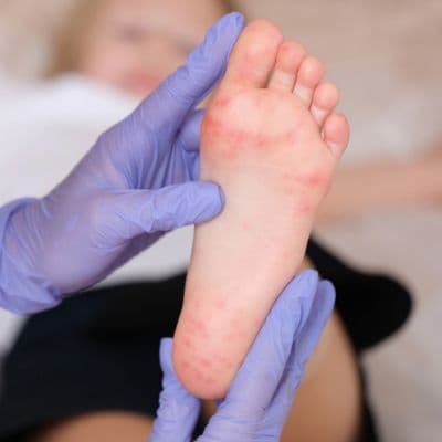 Anatomía del pie: la guía para entender por qué te duele al caminar