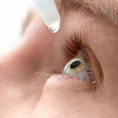Visión borrosa y 'moscas': así se manifiesta la toxoplasmosis en los ojos