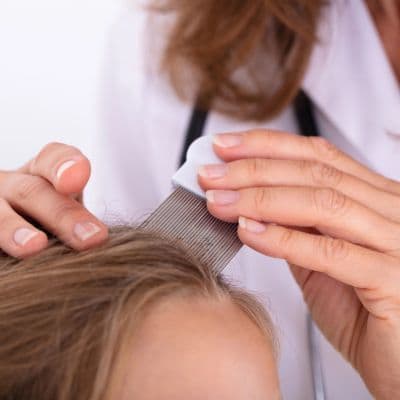 Qué son las liendres y cómo eliminarlas eficazmente