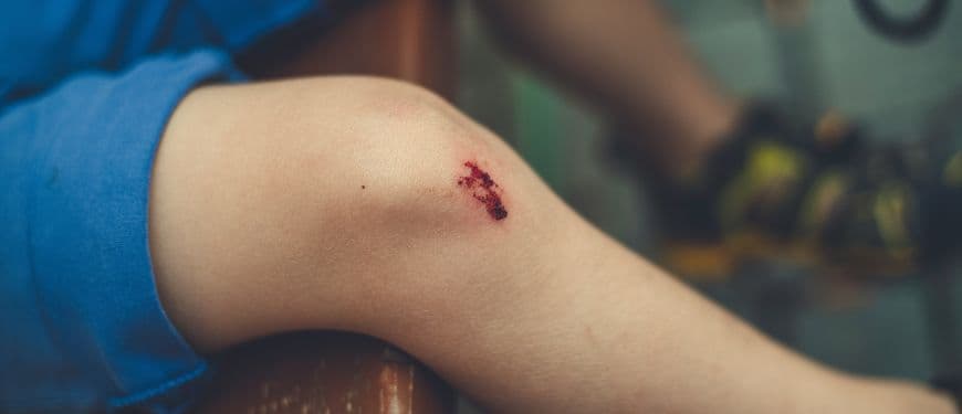 El muro invisible que impide curarte: por qué el biofilm bacteriano estanca tu herida