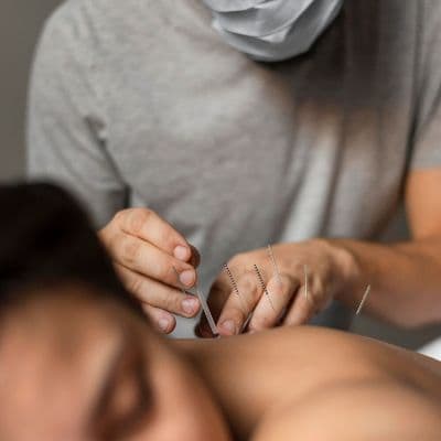 La verdad sobre la terapia de las agujas para aliviar el dolor crónico y la ansiedad