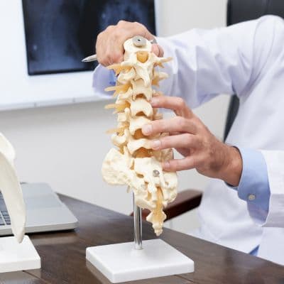 Cifosis cervical: Causas y ejercicios para el cuello