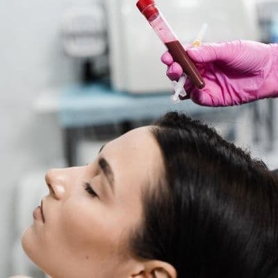 Vampire facial: qué es el tratamiento de PRP para la cara