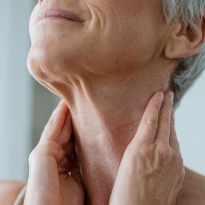 ¿Más de un bulto en el cuello? Lo que implica convivir con un bocio multinodular