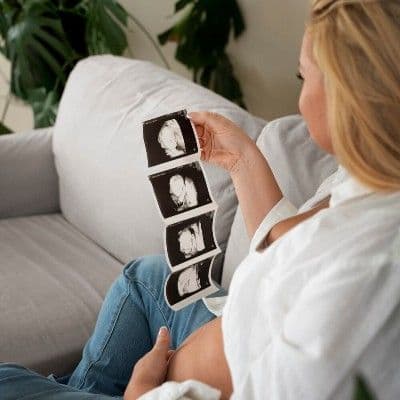 Acretismo placentario: la complicación más grave de la placenta previa