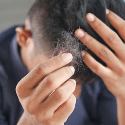 Folículo piloso: qué es, cómo funciona y por qué falla