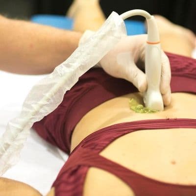 Dolor en el punto de McBurney: cómo identificar una apendicitis