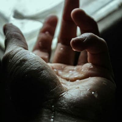 Tratamiento de la hiperhidrosis palmar: opciones para controlar el sudor