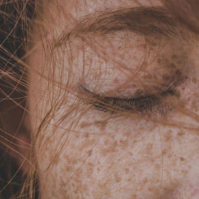 La irritación que aparece cuando tu sangre se queda estancada y cómo evitar que se convierta en herida